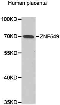 ZNF549 Antibody - Western blot analysis of extracts of human placenta.