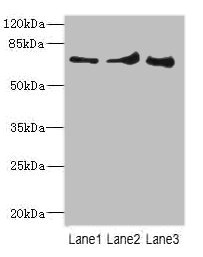 ZNF549 Antibody - Western blot All Lanes: ZNF549antibody at 1.09ug/ml Lane 1 : A549 whole cell lysate Lane 2 : Hela whole cell lysate Lane 3 : Human placenta tissue Secondary Goat polyclonal to Rabbit IgG at 1/10000 dilution Predicted band size: 75,73 kDa Observed band size: 74 kDa