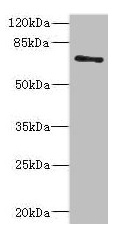 ZNF549 Antibody - Western blot All lanes: ZNF549 antibody at 1.09µg/ml + A549 whole cell lysate Secondary Goat polyclonal to rabbit IgG at 1/10000 dilution Predicted band size: 75, 73 kDa Observed band size: 75 kDa