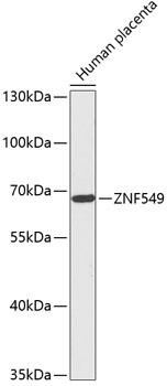 ZNF549 Antibody - Western blot analysis of extracts of Human placenta using ZNF549 Polyclonal Antibody at dilution of 1:1000.