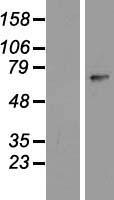 ZNF549 Protein - Western validation with an anti-DDK antibody * L: Control HEK293 lysate R: Over-expression lysate