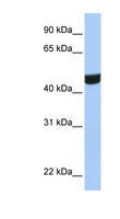 ZNF550 Antibody - ZNF550 antibody Western blot of Fetal Brain lysate. This image was taken for the unconjugated form of this product. Other forms have not been tested.