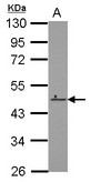 ZNF550 Antibody - Sample (30 ug of whole cell lysate) A: K562 10% SDS PAGE ZNF550 antibody diluted at 1:1000