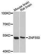 ZNF550 Antibody - Western blot analysis of extracts of various cell lines, using ZNF550 antibody at 1:3000 dilution. The secondary antibody used was an HRP Goat Anti-Rabbit IgG (H+L) at 1:10000 dilution. Lysates were loaded 25ug per lane and 3% nonfat dry milk in TBST was used for blocking. An ECL Kit was used for detection and the exposure time was 90s.