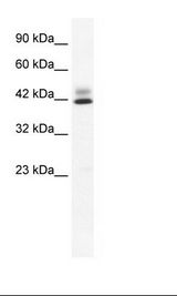 ZNF551 Antibody - Jurkat Cell Lysate.  This image was taken for the unconjugated form of this product. Other forms have not been tested.