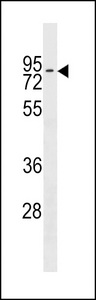 ZNF551 Antibody - ZNF551 Antibody western blot of NCI-H292 cell line lysates (35 ug/lane). The ZNF551 antibody detected the ZNF551 protein (arrow).