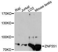 ZNF551 Antibody - Western blot analysis of extracts of various cell lines, using ZNF551 antibody at 1:3000 dilution. The secondary antibody used was an HRP Goat Anti-Rabbit IgG (H+L) at 1:10000 dilution. Lysates were loaded 25ug per lane and 3% nonfat dry milk in TBST was used for blocking. An ECL Kit was used for detection and the exposure time was 90s.