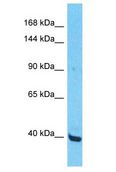 ZNF552 Antibody - ZNF552 antibody Western Blot of Jurkat. Antibody dilution: 1 ug/ml.  This image was taken for the unconjugated form of this product. Other forms have not been tested.