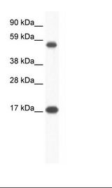 ZNF554 Antibody - Placenta Lysate.  This image was taken for the unconjugated form of this product. Other forms have not been tested.