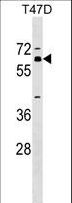 ZNF554 Antibody - ZNF554 Antibody western blot of T47D cell line lysates (35 ug/lane). The ZNF554 antibody detected the ZNF554 protein (arrow).