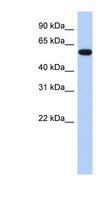 ZNF554 Antibody - ZNF554 antibody Western blot of MCF7 cell lysate. This image was taken for the unconjugated form of this product. Other forms have not been tested.