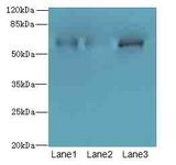 ZNF554 Antibody - Western blot. All lanes: ZNF554 antibody at 5 ug/ml. Lane 1: K562 whole cell lysate. Lane 2: U937 whole cell lysate. Lane 3: A549 whole cell lysate. Secondary Goat polyclonal to Rabbit IgG at 1:10000 dilution. Predicted band size: 61 kDa. Observed band size: 61 kDa.