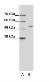 ZNF555 Antibody - A: Marker, B: 293T Cell Lysate.  This image was taken for the unconjugated form of this product. Other forms have not been tested.