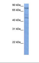 ZNF555 Antibody - Hela cell lysate. Antibody concentration: 0.5 ug/ml. Gel concentration: 12%.  This image was taken for the unconjugated form of this product. Other forms have not been tested.