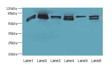 ZNF555 Antibody - Western blot. All lanes: ZNF555 antibody at 2 ug/ml. Lane 1: HepG-2 whole cell lysate. Lane 2: 293T whole cell lysate. Lane 3: HeLa whole cell lysate. Lane 4: Jurkat whole cell lysate. Lane 5: Mouse liver tissue. Lane 6: Mouse lung tissue. Secondary Goat polyclonal to Rabbit IgG at 1:10000 dilution. Predicted band size: 73 kDa. Observed band size: 73 kDa.