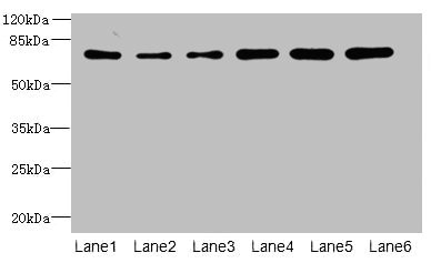 ZNF555 Antibody - Western blot All lanes: ZNF555 antibody at 2µg/ml Lane 1: HepG2 whole cell lysate Lane 2: 293T whole cell lysate Lane 3: Hela whole cell lysate Lane 4: Jurkat whole cell lysate Lane 5: Mouse liver tissue Lane 6: Mouse lung tissue Secondary Goat polyclonal to rabbit IgG at 1/10000 dilution Predicted band size: 74, 64, 73 kDa Observed band size: 74 kDa