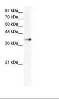 ZNF556 Antibody - HepG2 Cell Lysate.  This image was taken for the unconjugated form of this product. Other forms have not been tested.