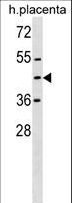 ZNF558 Antibody - ZNF558 Antibody western blot of human placenta tissue lysates (35 ug/lane). The ZNF558 Antibody detected the ZNF558 protein (arrow).