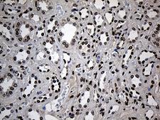 ZNF558 Antibody - Immunohistochemical staining of paraffin-embedded Human Kidney tissue within the normal limits using anti-ZNF558 mouse monoclonal antibody. (Heat-induced epitope retrieval by 1mM EDTA in 10mM Tris buffer. (pH8.5) at 120°C for 3 min. (1:150)