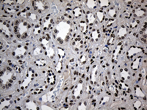 ZNF558 Antibody - Immunohistochemical staining of paraffin-embedded Human Kidney tissue within the normal limits using anti-ZNF558 mouse monoclonal antibody. (Heat-induced epitope retrieval by 1mM EDTA in 10mM Tris buffer. (pH8.5) at 120°C for 3 min. (1:150)