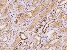 ZNF558 Antibody - Immunochemical staining of human ZNF558 in human kidney with rabbit polyclonal antibody at 1:500 dilution, formalin-fixed paraffin embedded sections.