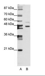 ZNF558 Antibody - A: Marker, B: Jurkat Cell Lysate.  This image was taken for the unconjugated form of this product. Other forms have not been tested.