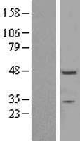 ZNF558 Protein - Western validation with an anti-DDK antibody * L: Control HEK293 lysate R: Over-expression lysate