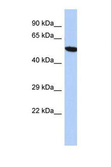 ZNF559 Antibody - Western blot of Human HepG2. ZNF559 antibody dilution 1.0 ug/ml.  This image was taken for the unconjugated form of this product. Other forms have not been tested.