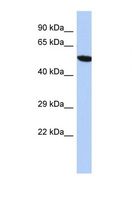 ZNF559 Antibody - Western blot of Human HepG2. ZNF559 antibody dilution 1.0 ug/ml.  This image was taken for the unconjugated form of this product. Other forms have not been tested.