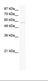 ZNF559 Antibody - Jurkat Cell Lysate.  This image was taken for the unconjugated form of this product. Other forms have not been tested.