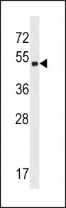 ZNF559 Antibody - ZNF559 Antibody western blot of A2058 cell line lysates (35 ug/lane). The ZNF559 antibody detected the ZNF559 protein (arrow).