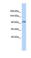 ZNF560 Antibody - ZNF560 antibody Western blot of HeLa lysate. This image was taken for the unconjugated form of this product. Other forms have not been tested.