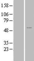 ZNF561 Protein - Western validation with an anti-DDK antibody * L: Control HEK293 lysate R: Over-expression lysate