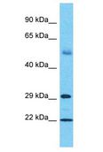 ZNF562 Antibody - ZNF562 antibody Western Blot of Thymus Tumor. Antibody dilution: 1 ug/ml.  This image was taken for the unconjugated form of this product. Other forms have not been tested.
