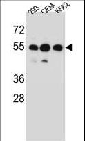 ZNF562 Antibody - ZNF562 Antibody western blot of 293,CEM,K562 cell line lysates (35 ug/lane). The ZNF562 antibody detected the ZNF562 protein (arrow).