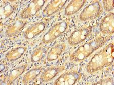 ZNF562 Antibody - Immunohistochemistry of paraffin-embedded human small intestine tissue using ZNF562 Antibody at dilution of 1:100