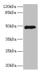 ZNF562 Antibody - Western blot All lanes: ZNF562 antibody at 12µg/ml + 293T whole cell lysate Secondary Goat polyclonal to rabbit IgG at 1/10000 dilution Predicted band size: 49, 41 kDa Observed band size: 49 kDa