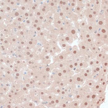 ZNF562 Antibody - Immunohistochemistry of paraffin-embedded Mouse liver using ZNF562 Polyclonal Antibody at dilution of 1:100 (40x lens).
