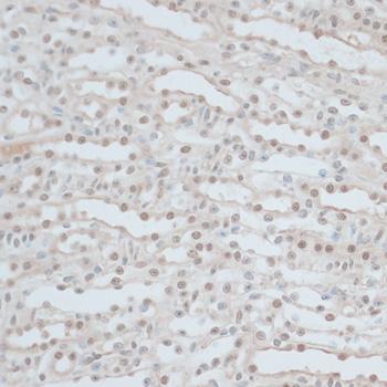 ZNF562 Antibody - Immunohistochemistry of paraffin-embedded Mouse kidney using ZNF562 Polyclonal Antibody at dilution of 1:100 (40x lens).