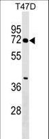 ZNF563 Antibody - ZNF563 Antibody western blot of T47D cell line lysates (35 ug/lane). The ZNF563 antibody detected the ZNF563 protein (arrow).