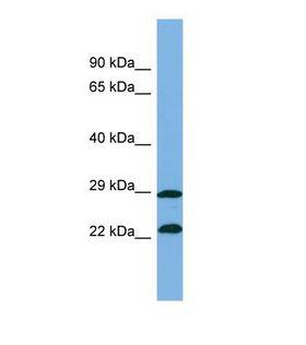 ZNF563 Antibody - Western blot of Human ACHN Whole cell . ZNF563 antibody dilution 1.0 ug/ml.  This image was taken for the unconjugated form of this product. Other forms have not been tested.