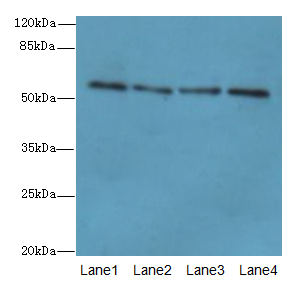 ZNF563 Antibody - Western blot. All lanes: ZNF563 antibody at 7 ug/ml. Lane 1: HeLa whole cell lysate. Lane 2: A549 whole cell lysate. Lane 3: MCF7 whole cell lysate. Lane 4: K562 whole cell lysate. Secondary Goat polyclonal to Rabbit IgG at 1:10000 dilution. Predicted band size: 55 kDa. Observed band size: 55 kDa.