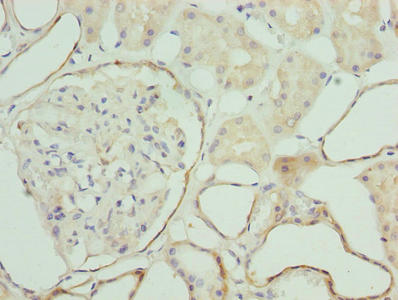 ZNF563 Antibody - Immunohistochemistry of paraffin-embedded human kidney tissue using ZNF563 Antibody at dilution of 1:100