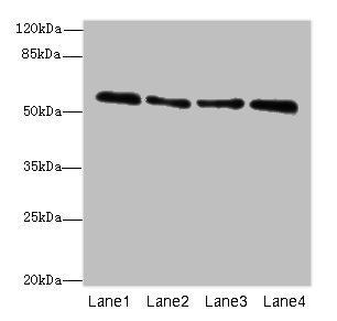 ZNF563 Antibody - Western blot All lanes: ZNF563 antibody at 7µg/ml Lane 1: Hela whole cell lysate Lane 2: A549 whole cell lysate Lane 3: MCF-7 whole cell lysate Lane 4: K562 whole cell lysate Secondary Goat polyclonal to rabbit IgG at 1/10000 dilution Predicted band size: 56, 27 kDa Observed band size: 56 kDa
