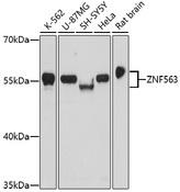 ZNF563 Antibody - Western blot analysis of extracts of various cell lines using ZNF563 Polyclonal Antibody at dilution of 1:1000.