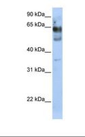 ZNF564 Antibody - Transfected 293T cell lysate. Antibody concentration: 1.0 ug/ml. Gel concentration: 12%.  This image was taken for the unconjugated form of this product. Other forms have not been tested.