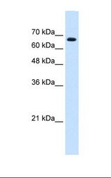 ZNF564 Antibody - Jurkat cell lysate. Antibody concentration: 0.25 ug/ml. Gel concentration: 12%.  This image was taken for the unconjugated form of this product. Other forms have not been tested.