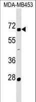 ZNF565 Antibody - ZNF565 Antibody western blot of MDA-MB453 cell line lysates (35 ug/lane). The ZNF565 antibody detected the ZNF565 protein (arrow).