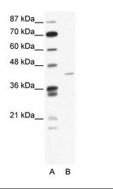 ZNF568 Antibody - A: Marker, B: HepG2 Cell Lysate.  This image was taken for the unconjugated form of this product. Other forms have not been tested.