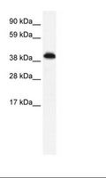ZNF568 Antibody - Fetal Brain Lysate.  This image was taken for the unconjugated form of this product. Other forms have not been tested.